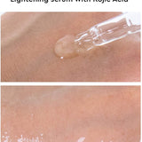 Evagloss Dark Spot Corrector Serum with Kojic Acid and Natural Ingredients for Face & Body, All Skin Types