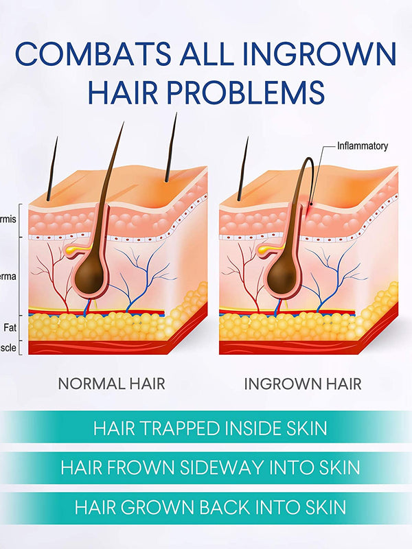 evagloss Razor Bump Stopper- After Shave Solution for Ingrown Hairs and Razor Burns