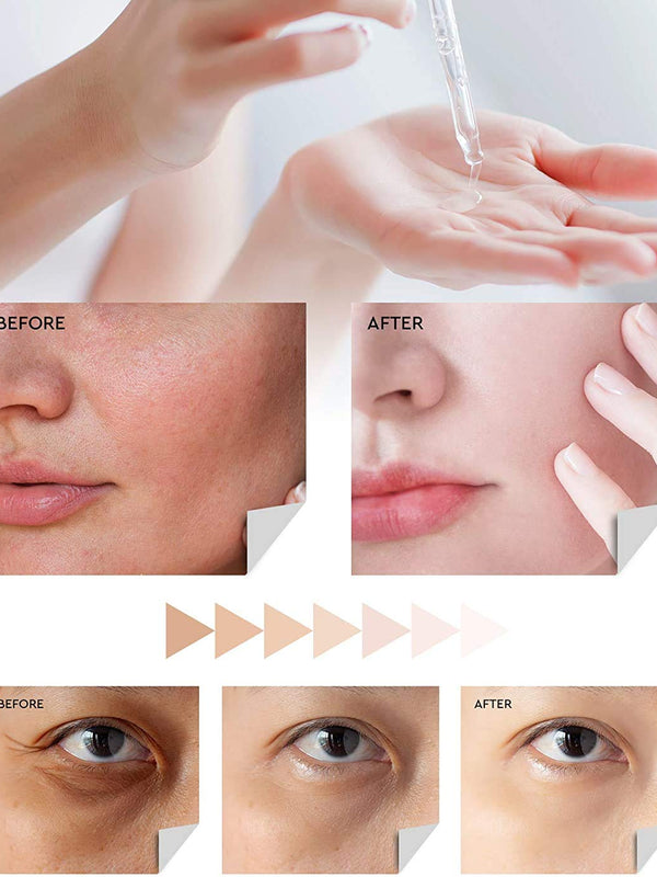 Evagloss Dark Spot Corrector Serum with Kojic Acid and Natural Ingredients for Face & Body, All Skin Types