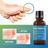 evagloss Natural Wart Remover, Maximum Strength, Painlessly Removes Plantar, Common, Genital Warts, Advanced Liquid Gel Formula, Proven Results