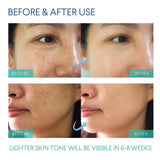 evagloss Razor Bump Stopper- After Shave Solution for Ingrown Hairs and Razor Burns