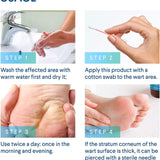 evagloss Natural Wart Remover, Maximum Strength, Painlessly Removes Plantar, Common, Genital Warts, Advanced Liquid Gel Formula, Proven Results