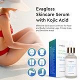 Evagloss Kojic Acid Serum with Arbutin for Face and Body - Best Natural and Gentle Treatment for Skin Discoloration for All Skin Types, 1oz.